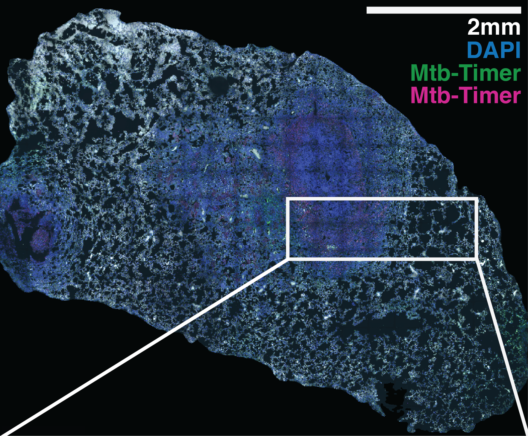Supplementary Figure S8A whole lung section